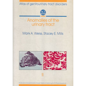 Anomalies of the urinary tract