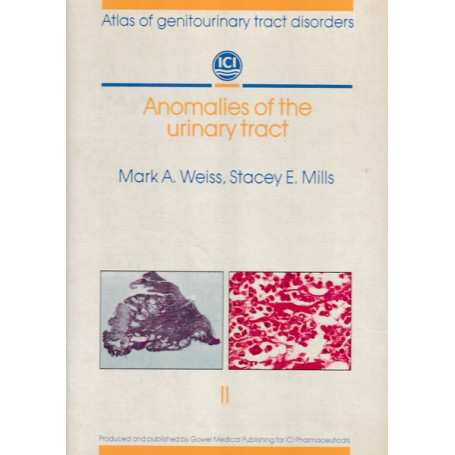 Anomalies of the urinary tract