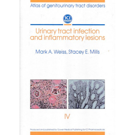 Urinary tract infection and inflammatory lesions