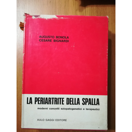 La periartrite della spalla