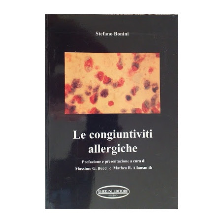 Le congiuntiviti allergiche