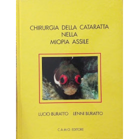 Chirurgia della cataratta nella miopia assile
