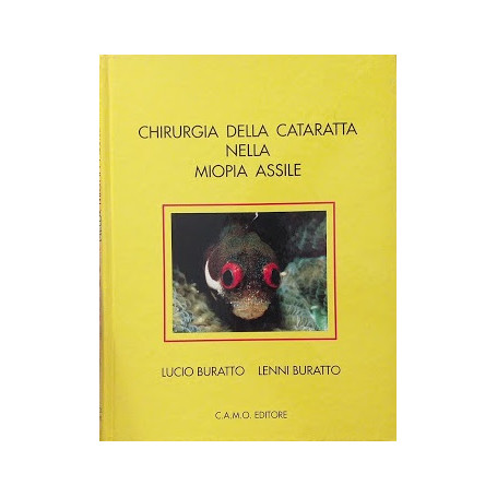 Chirurgia della cataratta nella miopia assile