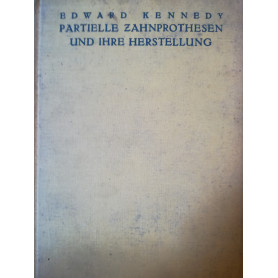 Partielle Zahnprothesen und ihre Herstellung