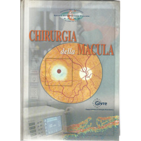 Chirurgia della macula