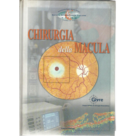 Chirurgia della macula