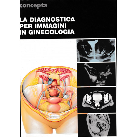 La diagnostica per immagini in ginecologia