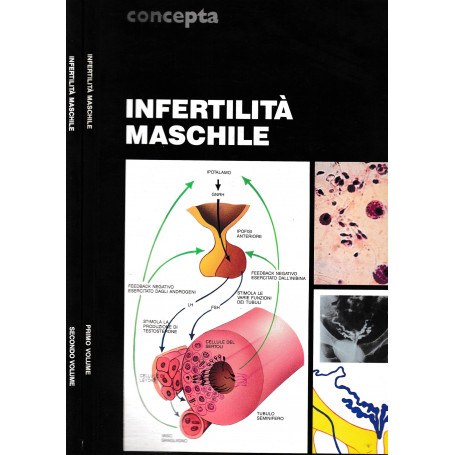 Infertilità  maschile