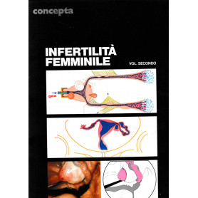 Infertilità  femminile