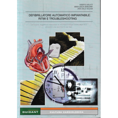 Defibrillatore automatico impiantabile: Ritmi e Troubleshooting