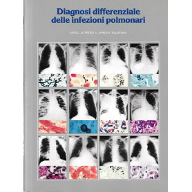 Diagnosi differenziale delle infezioni polmonari