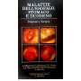 Malattie dell' esofago stomaco e duodeno