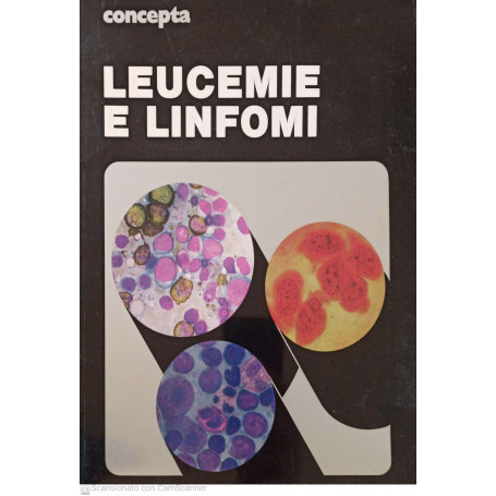 Leucemie e linfomi