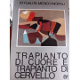 Trapianto di cuore e trapianto di cervello