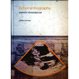 Echocardiography