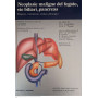 Neoplasie maligne del fegato vie biliari pancreas