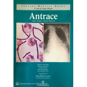 Antrace