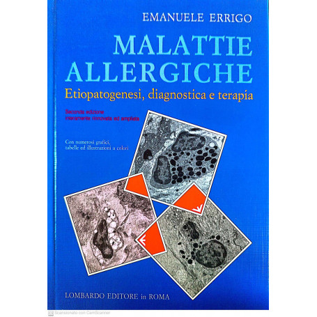 Malattie allergiche