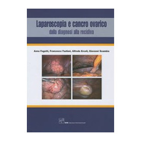 Laparoscopia e Cancro Ovarico - Dalla diagnosi alla recidiva