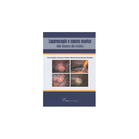 Laparoscopia e Cancro Ovarico - Dalla diagnosi alla recidiva