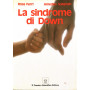 La sindrome di Down.