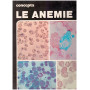 Concepta. Le anemie