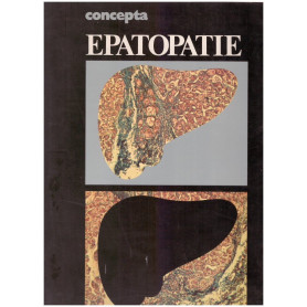 Concepta. Epatopatie
