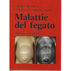 Malattie del fegato