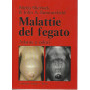 Malattie del fegato