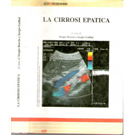 La cirrosi epatica