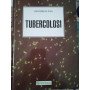 Tubercolosi