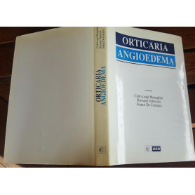 Orticaria Angioedema