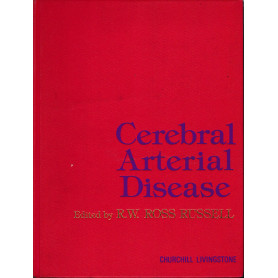 Cerebral Arterial Disease