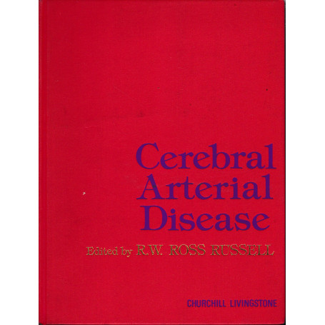 Cerebral Arterial Disease