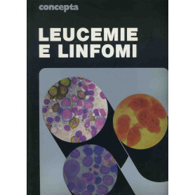 Leucemie e linfomi