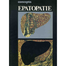 Epatopatie