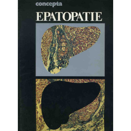 Epatopatie